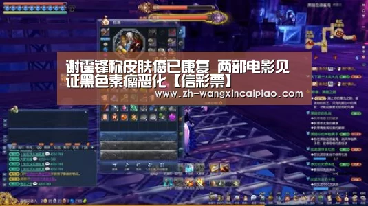 谢霆锋称皮肤癌已康复 两部电影见证黑色素瘤恶化【信彩票】